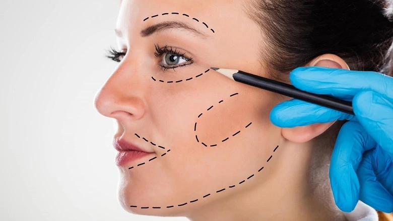 Myths About Facelift Surgery