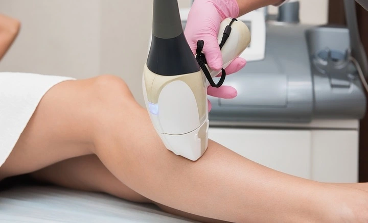 Advantages of Laser Hair Removal